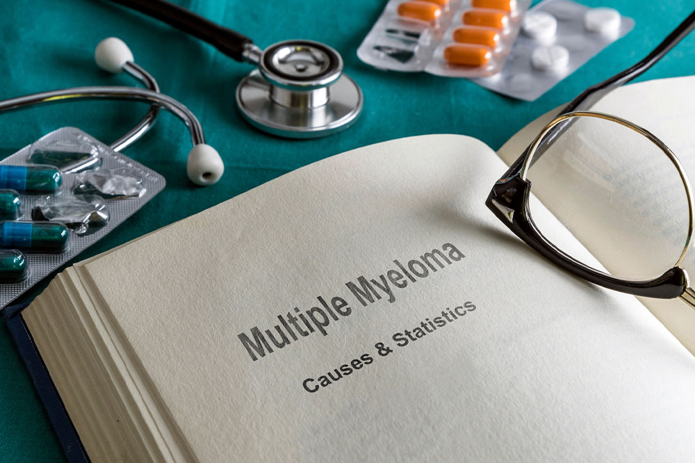 Multiple myeloma – Symptoms, causes, and management