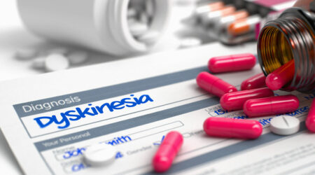 Dyskinesia – Types, symptoms, causes, and more
