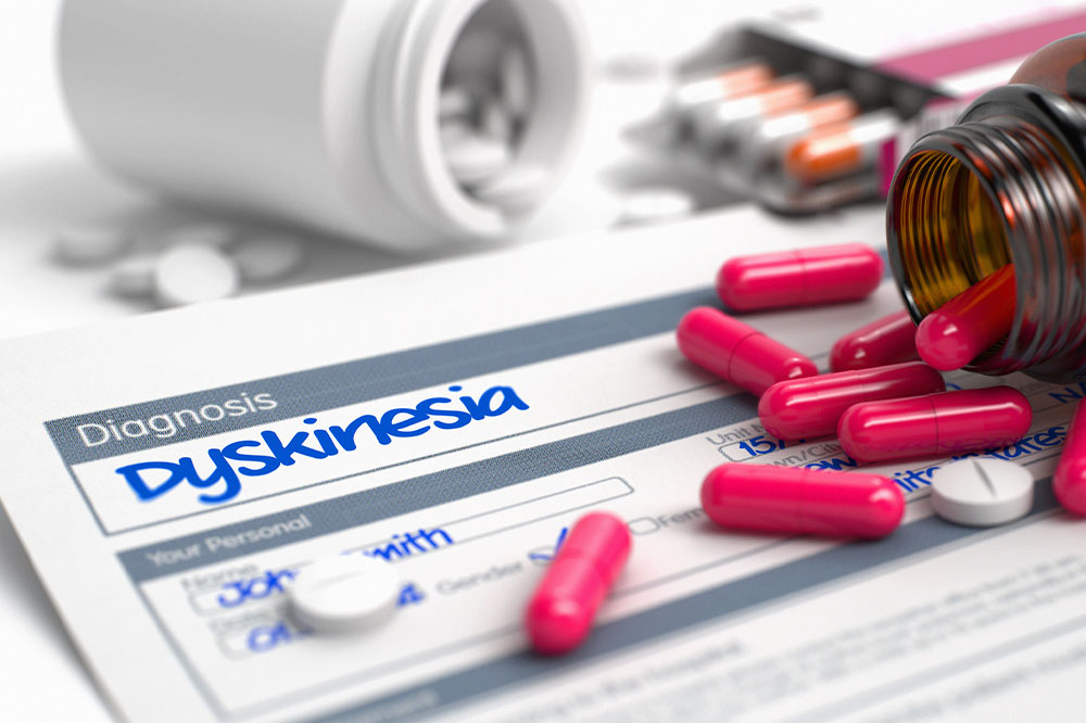 Dyskinesia – Types, symptoms, causes, and more