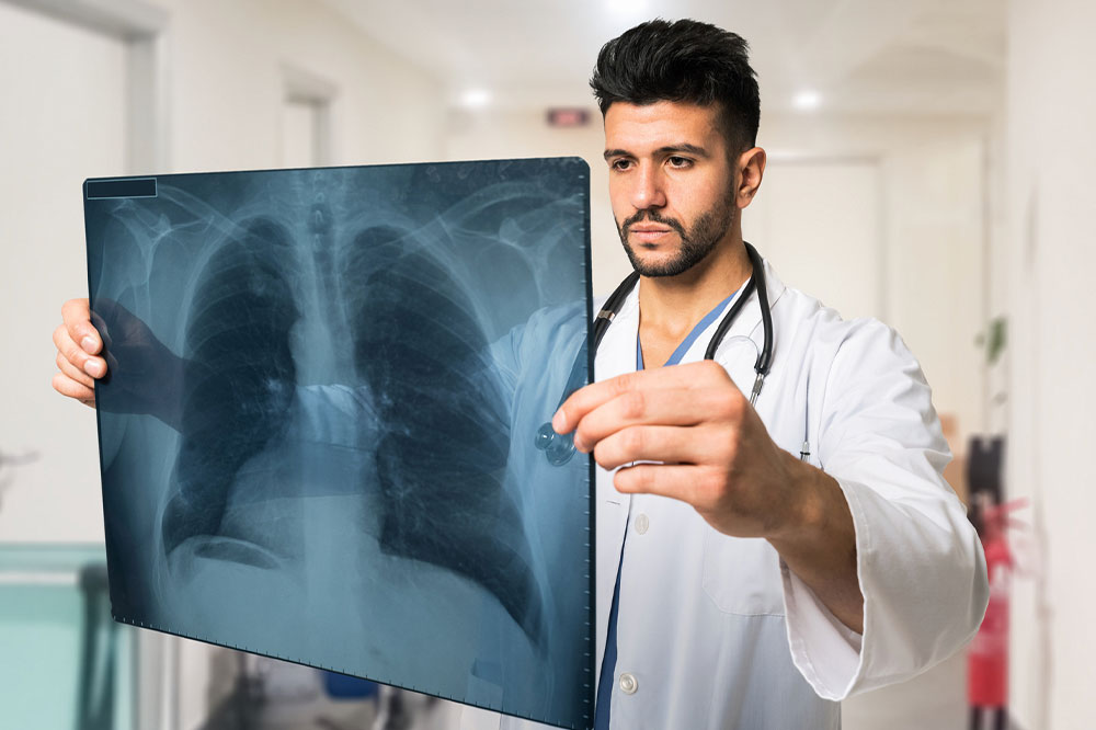 Lung cancer – Symptoms, causes, remedies, and more