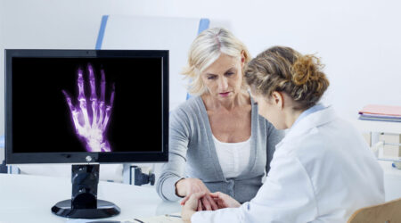 Rheumatoid arthritis – Symptoms, causes, and remedies