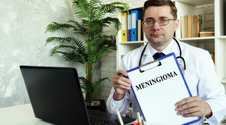 Meningioma – Causes, top symptoms, and management