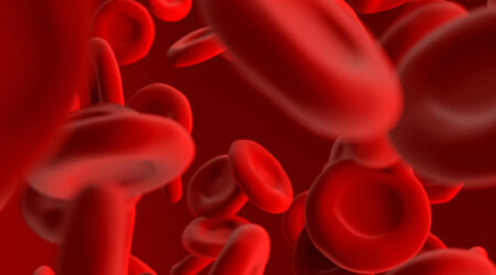 Nocturnal hemoglobinuria – Causes, symptoms, and management