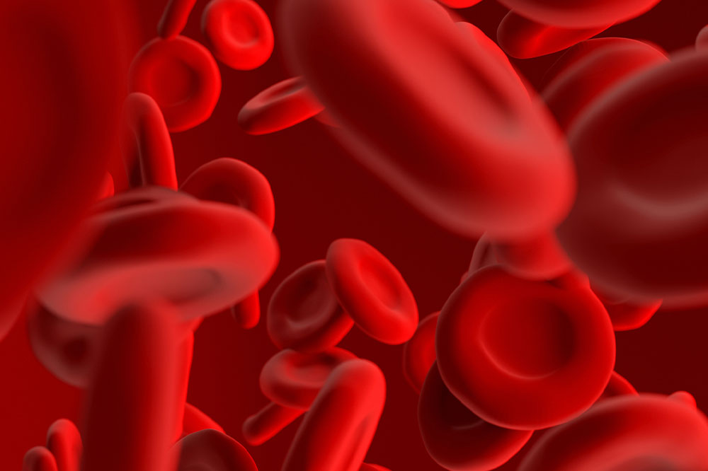 Nocturnal hemoglobinuria – Causes, symptoms, and management