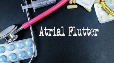 Atrial flutter – Types, symptoms, causes, and diagnosis