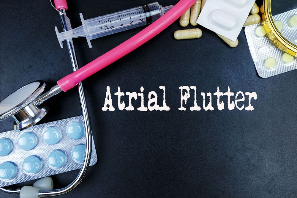 Atrial flutter – Types, symptoms, causes, and diagnosis