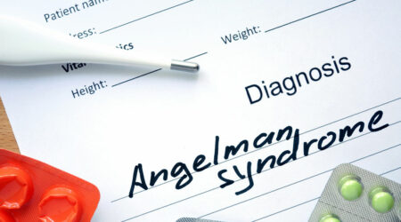 Angelman syndrome – Causes, symptoms, and management