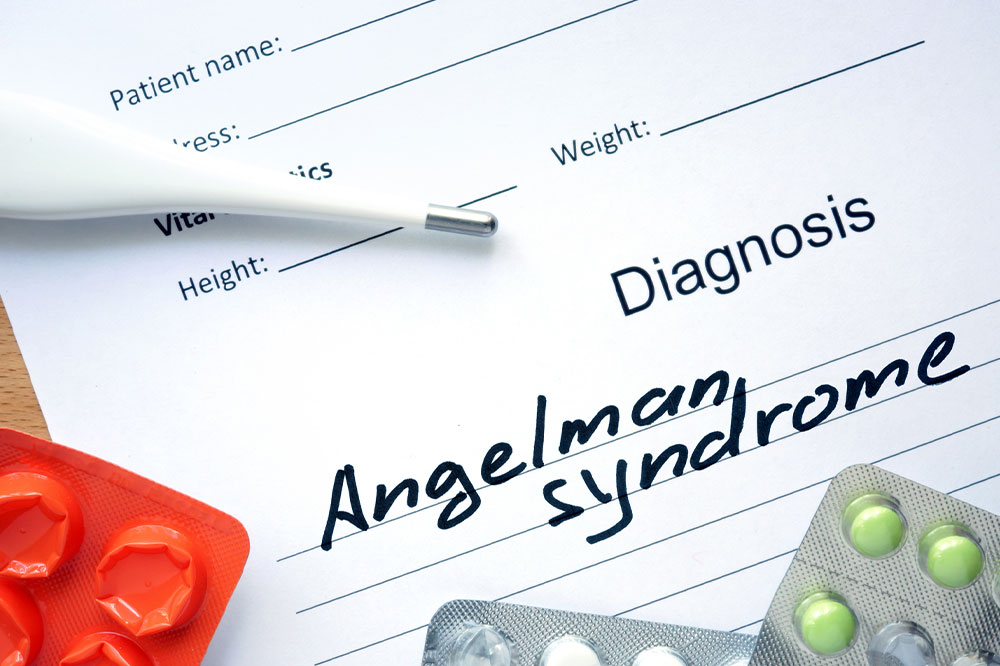 Angelman syndrome – Causes, symptoms, and management