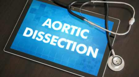 Aortic dissection – What it is and its management