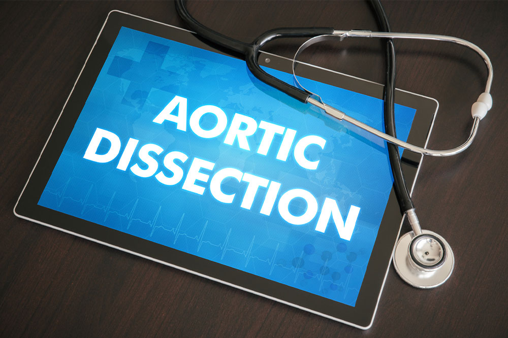 Aortic dissection – What it is and its management