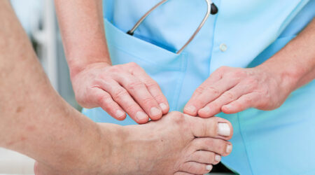 Bunion surgery – Types, cost, recovery, and more