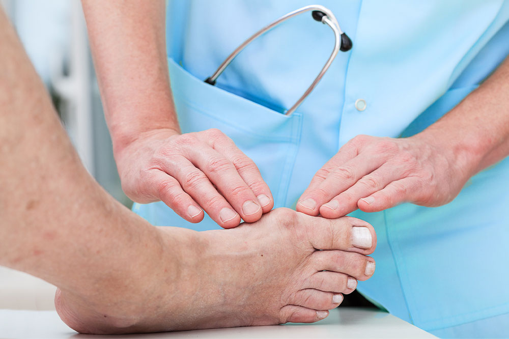 Bunion surgery – Types, cost, recovery, and more
