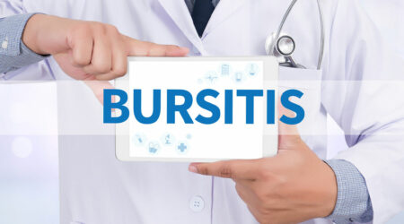 Bursitis – Causes, symptoms, and preventive measures