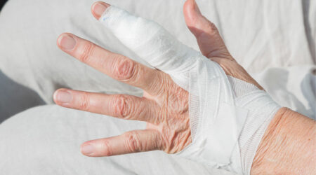 Bible cysts – Causes, symptoms, and management options