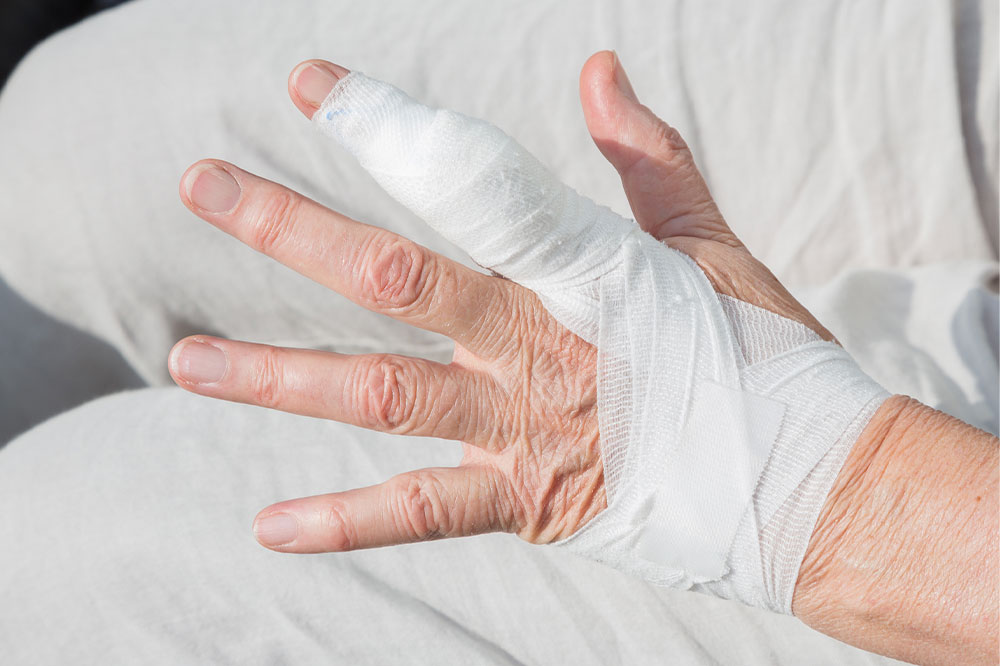 Bible cysts – Causes, symptoms, and management options