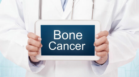 Bone cancer – Causes, warning signs, and management