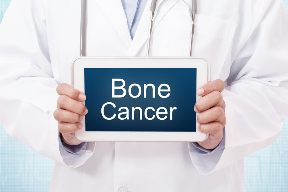 Bone cancer – Causes, warning signs, and management