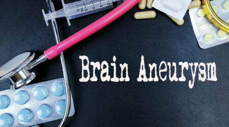 Brain aneurysm – Causes, symptoms, and management options