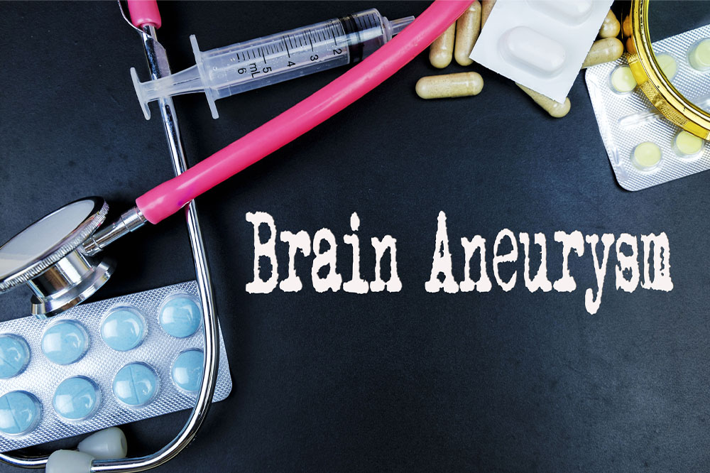Brain aneurysm – Causes, symptoms, and management options