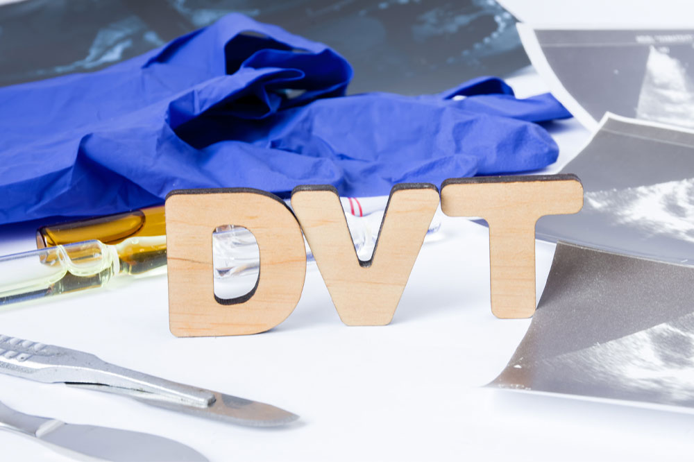 Deep vein thrombosis – Symptoms, causes, and management