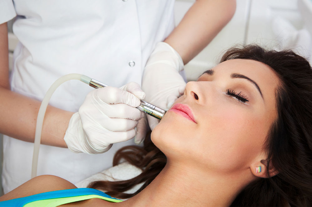 Guide to laser resurfacing for acne scars