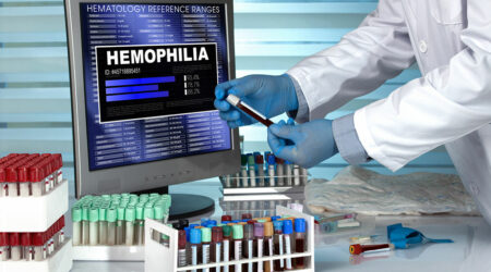 Hemophilia – Its symptoms, causes, and management