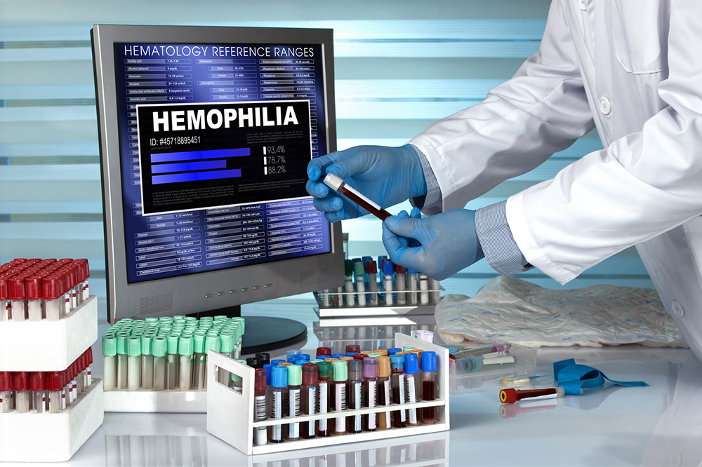 Hemophilia – Its symptoms, causes, and management