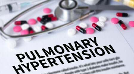Pulmonary hypertension – Types, symptoms, and causes