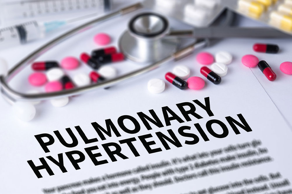 Pulmonary hypertension – Types, symptoms, and causes