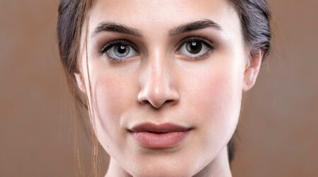 Symptoms, causes, and management of heterochromia iridis