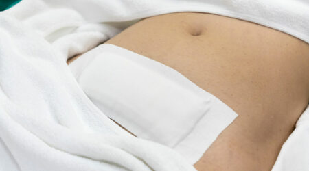 Myomectomy – Types, symptoms, and management