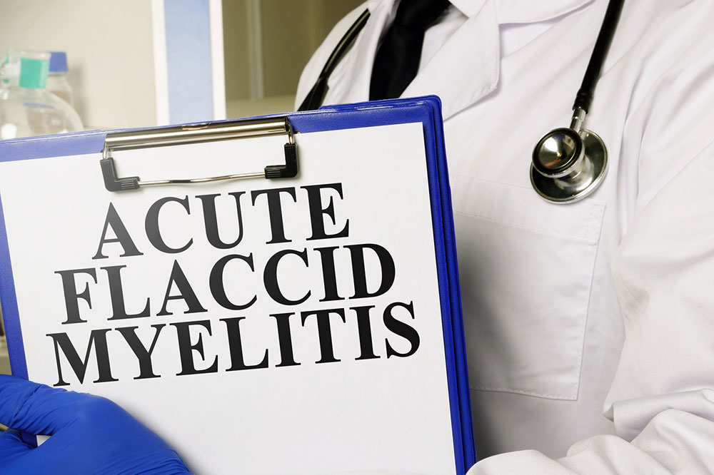 Acute flaccid myelitis – Signs, causes, diagnosis , and more