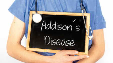 Addison’s disease – Symptoms, causes, and management