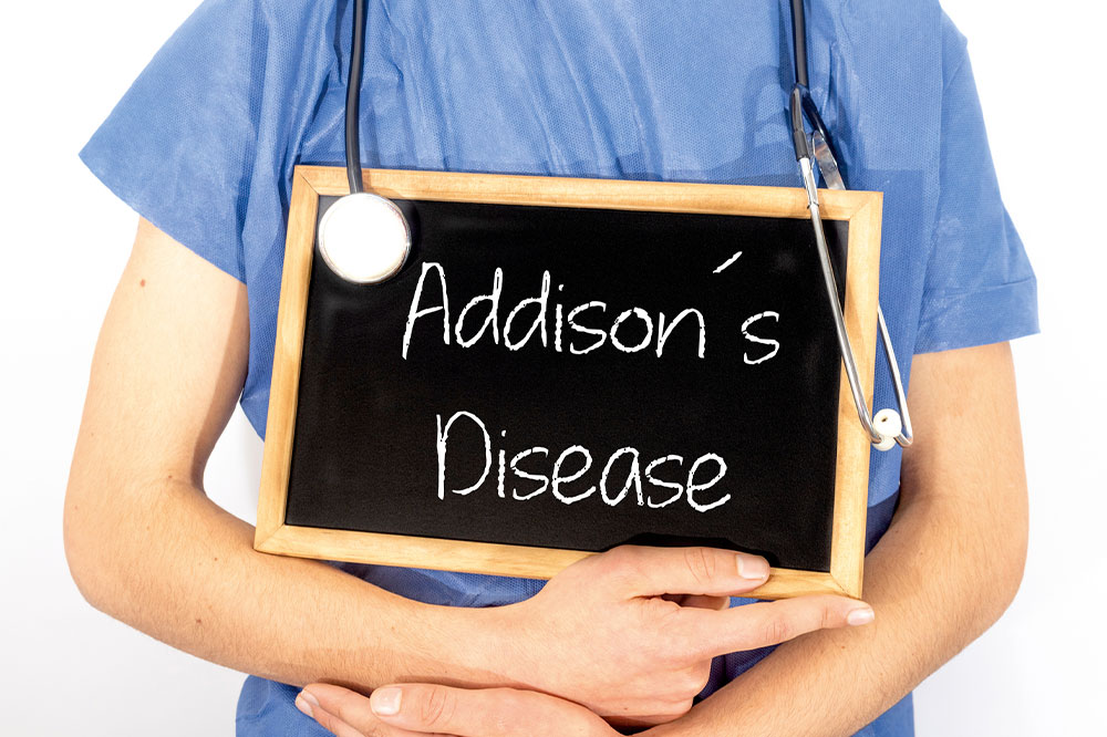 Addison’s disease – Symptoms, causes, and management
