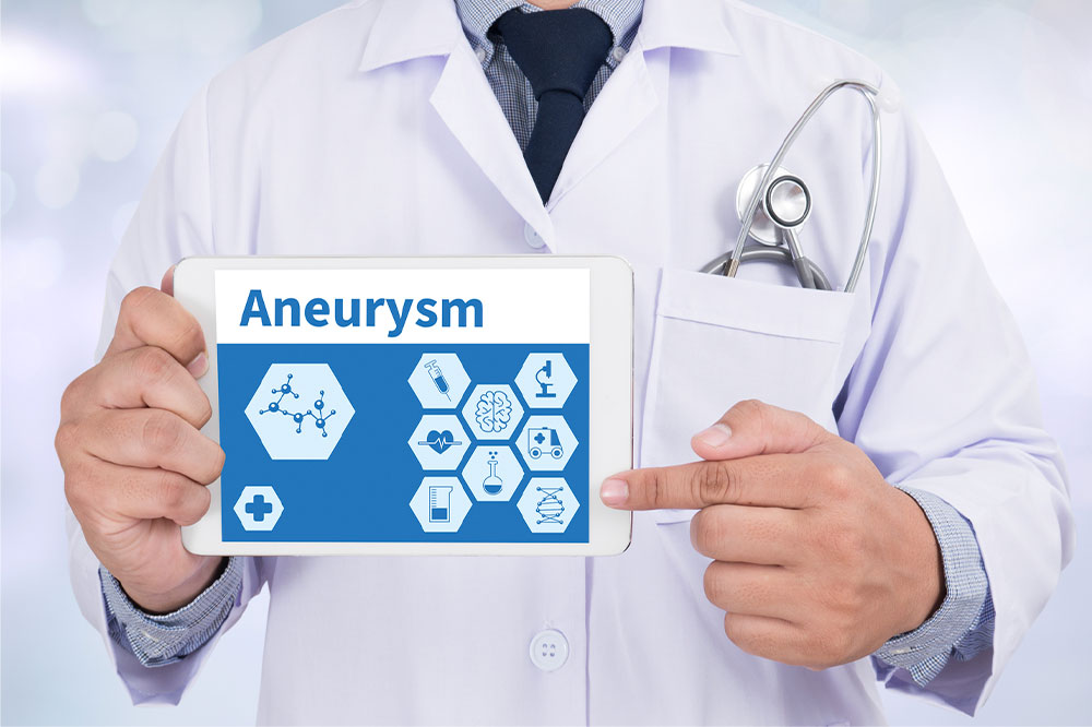 Aneurysm – Types, symptoms, and management