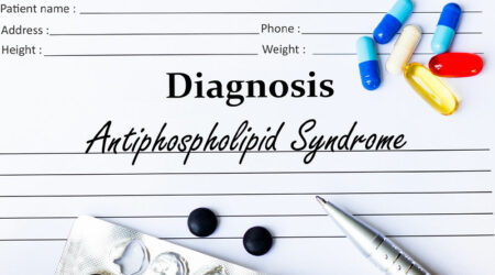 Antiphospholipid syndrome – Signs, causes, diagnosis, and more