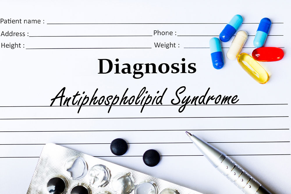 Antiphospholipid syndrome – Signs, causes, diagnosis, and more