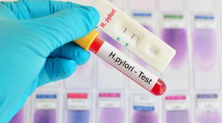 Helicobacter pylori – Causes, signs, and management of the infection