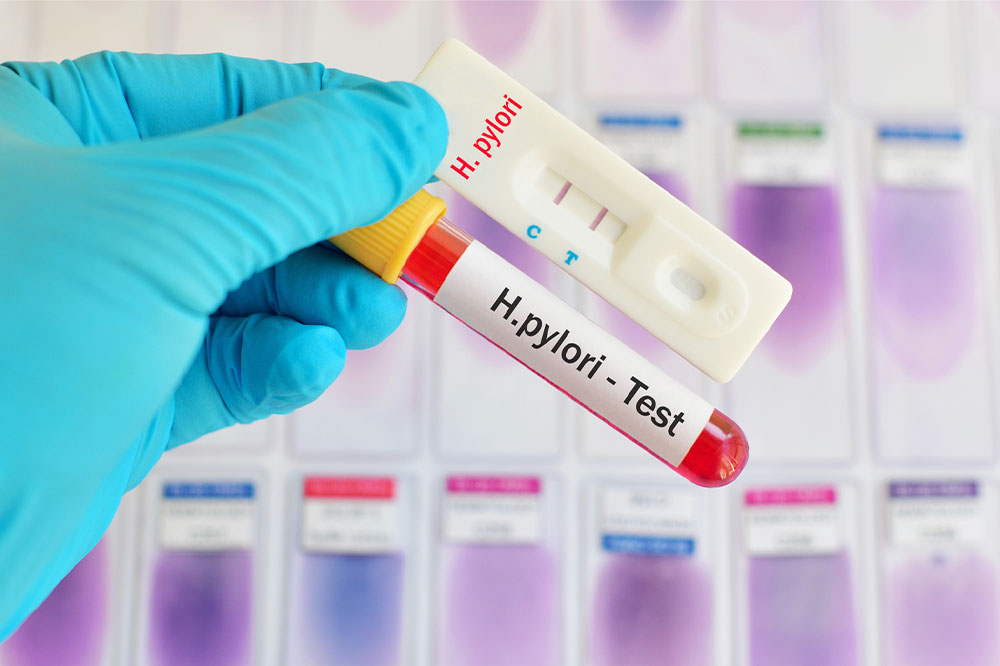 Helicobacter pylori – Causes, signs, and management of the infection