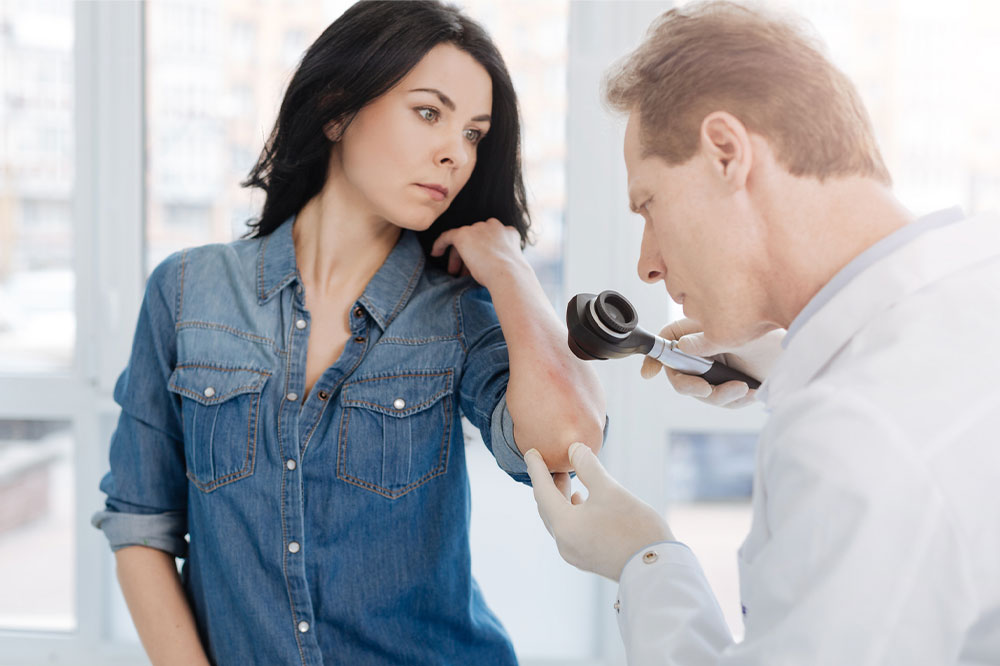 Psoriasis – Signs, causes, and management options